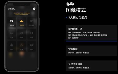 3年7輪融資，深至科技的超聲AI 資本熱潮下的硬核實(shí)力與軟件研發(fā)真章